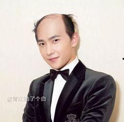 秃子明星,揭秘秃子明星的独特风采