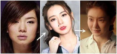 整容失败的明星人,一场人生逆袭的华丽蜕变